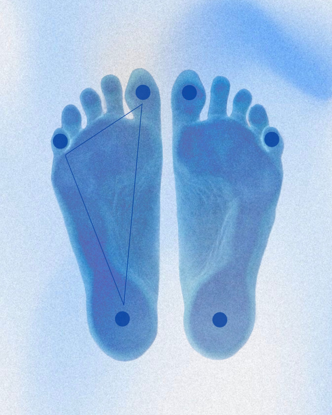TABI technology